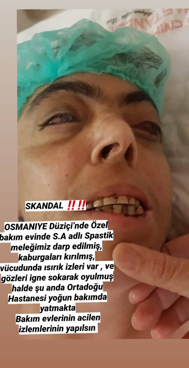 nazanyasarbas's tweet photo. Ben bir otizmli çocuk annesi olarak ben öldükten sonra ne olucak değil bizler ölmeden ne olacaklarına endişeliyim yetkililerimize sesleniyorum sivil toplum kuruluşları ile birlikte çalışmalar yapılsın  @RTErdogan @tcbestepe @drfahrettinkoca @ailevecalisma @ziyaselcuk https://t.co/fiffYmcjF4