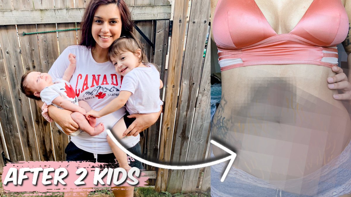 alanasingh48's tweet photo. ‼️NEW VIDEO ‼️
My body after 2 kids in 2 years | *TMI* What They Dont Tell You About Postpartum| 
https://t.co/ITlOFNlLcW https://t.co/DmTiePH3Vn