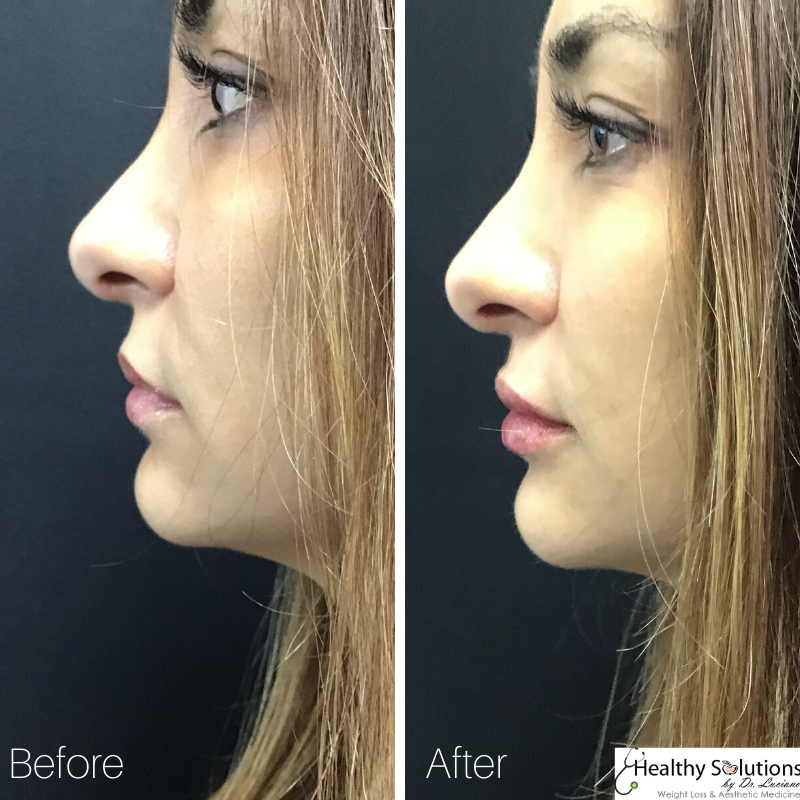 HlthySolMedSpa's tweet image. Love your lips at our #medspa
#buckscounty #buckscountypa #medicalspa 
#lips #lipinjections #lipfillers

Visit our website here:
healthysolutionsdr.com