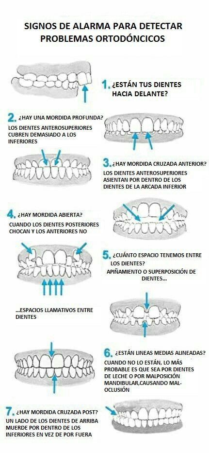 RagnarVzla's tweet photo. Signos de alarma para detectar problemas Ortodóncicos. https://t.co/Ts79Dc0dYd