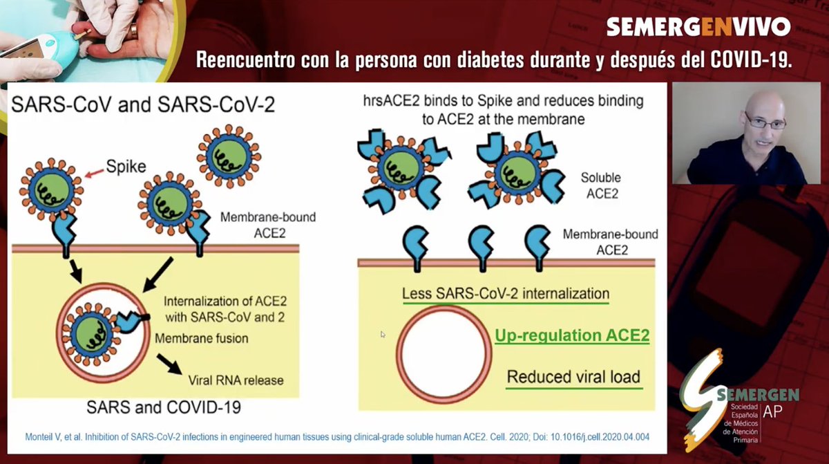 SEMERGENap's tweet photo. A pesar de la influencia de los #IECA y los #ARAII sobre el posible aumento de #ECA2 (sustrato del #SARSCoV2), los estudios dicen que no hay resultados negativos sino que, incluso, muestran beneficios en los pacientes que precisan estos fármacos.
Dr. @AntonioRuiz001 #Diabetes https://t.co/ko2IDuaBJt