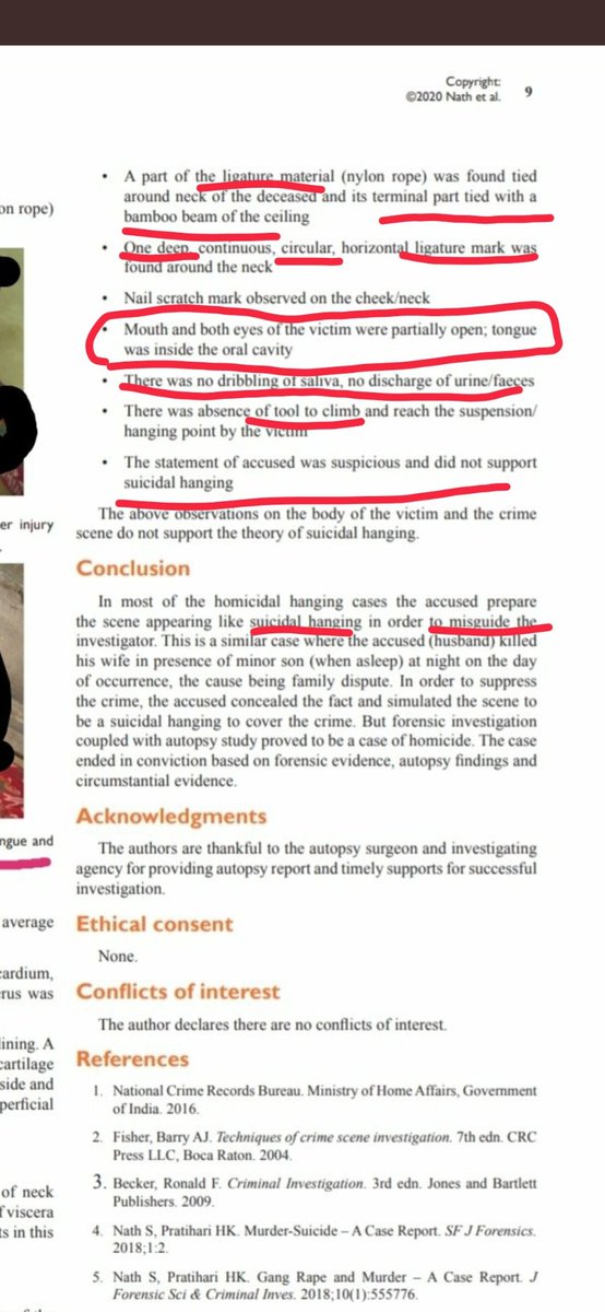 gate_xor's tweet photo. 1/3
See this. The exact similar case of homicide initially portrayed as suicide. One lady was murdered by her husband &amp; her dead body had similar signs as of Sushant. 
@RoopaSpeaks @justice_sushi @Payal_Rohatgi #CBIMustForSushant #SushantSingRajput #ArrestMurdererOfSushant https://t.co/DaPnbUt9ZS