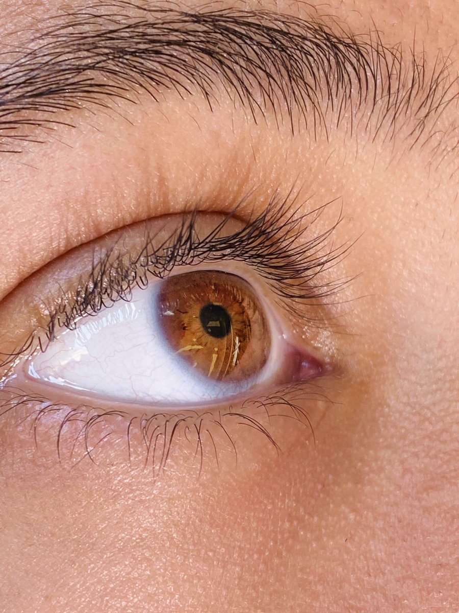 كيف نقدر نصور العين بدقَّة عالية؟ 
تابعوا معي سلسلة التغريدات
فضل التغريدة و تابع السرد :