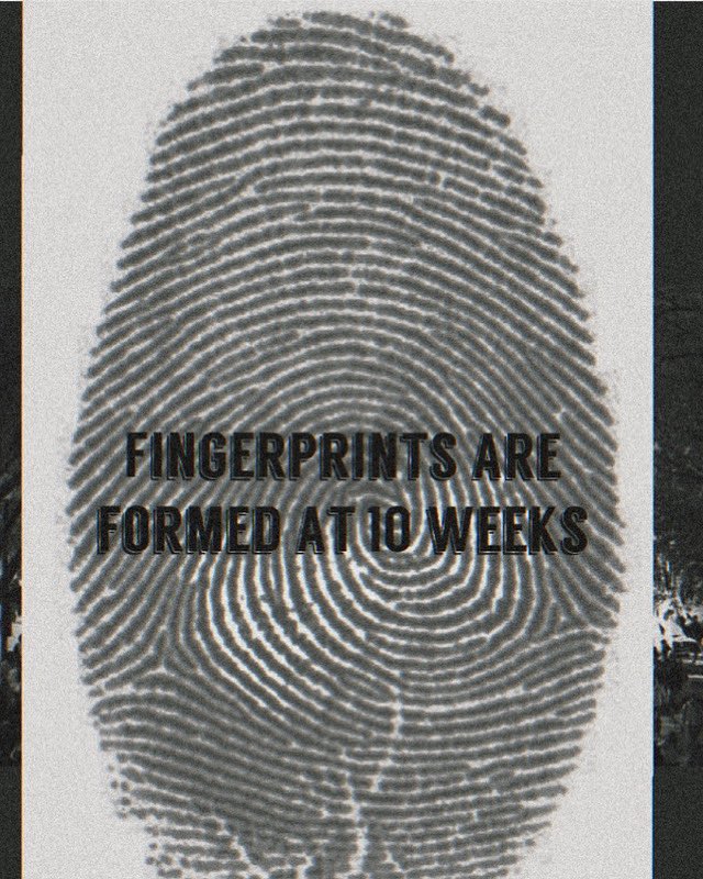 aChanceAtLife1's tweet photo. Fingerprints are formed at 10 weeks https://t.co/ijgPPsJFC6