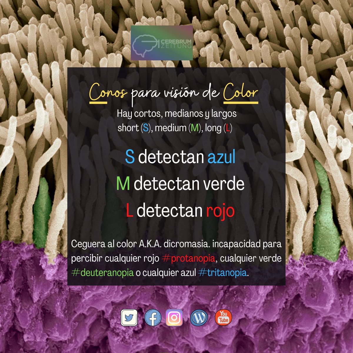CerebrumZeitung's tweet image. Los conos tienen mayor densidad en la #fovea retiniana. Fovea + conos= agudeza visual #dicromasia A.K.A. Ceguera al color. Defecto recesivo, ligado al sexo.

#medicina #neurociencia #neurologia #medmnemonics
