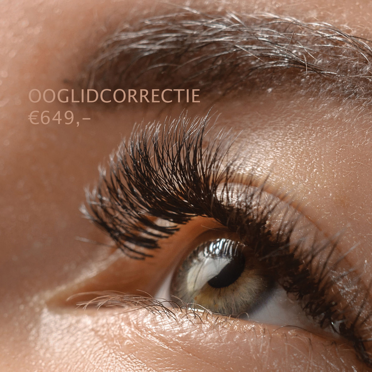 PolideBlaak's tweet photo. Bovenooglidcorrectie €649,- er is o.a. nog plek bij dr. Michel Visser Polikliniek de Blaak Rotterdam Tel. 085-4881700 https://t.co/cOSOPBMpbg