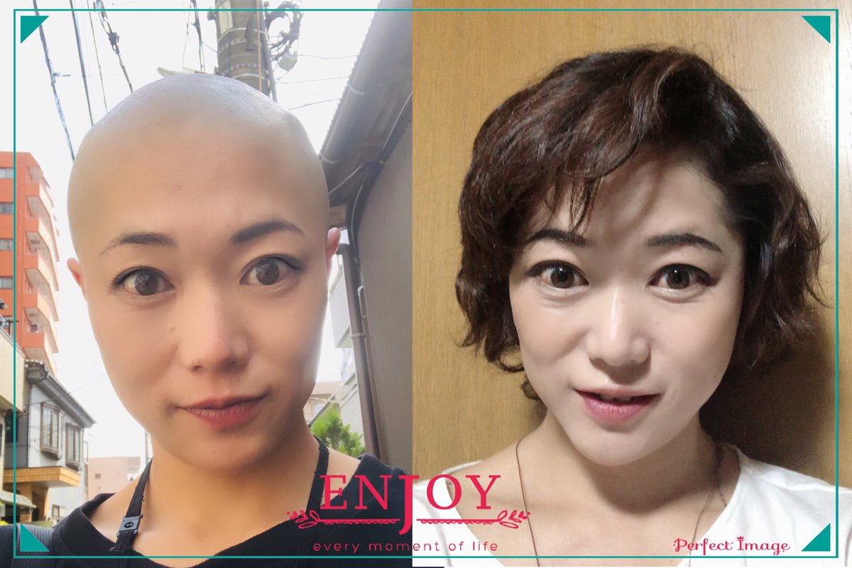 트위터의 藤岡範子 님 昨年 映画で剃髪した髪が先日 1歳になりました 途中 カツラから溢れ出るもみあげ と もさっっとなってる部分を少し切りましたが 長さはほぼ変えず 伸びるの遅いと言われますがビフォーアフターで1年後っ感じです 全剃りしたら髪質が変わる