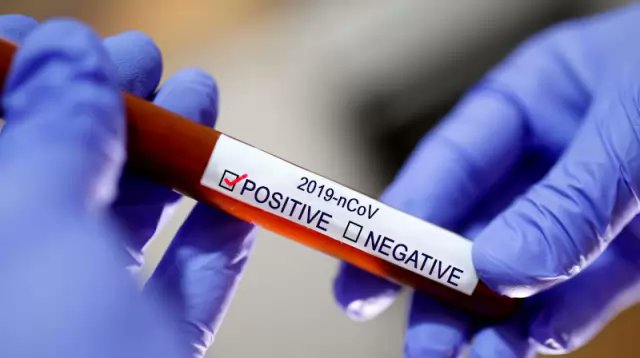 creativerezabd's tweet image. Affected 3531 and died 39 in Bangladesh in last 24 hours!
link.zalinks.com/cu3ZMY