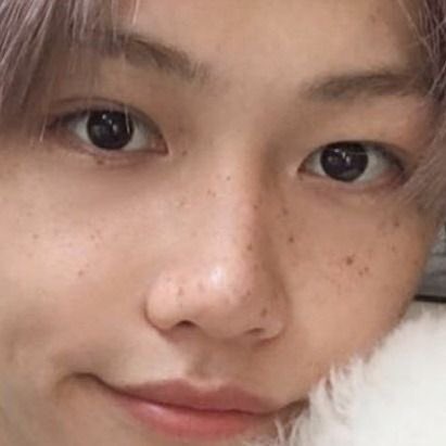 A thread of Felix beautiful freckles