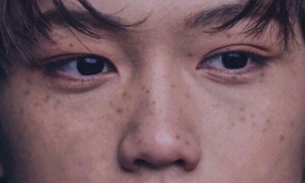 A thread of Felix beautiful freckles