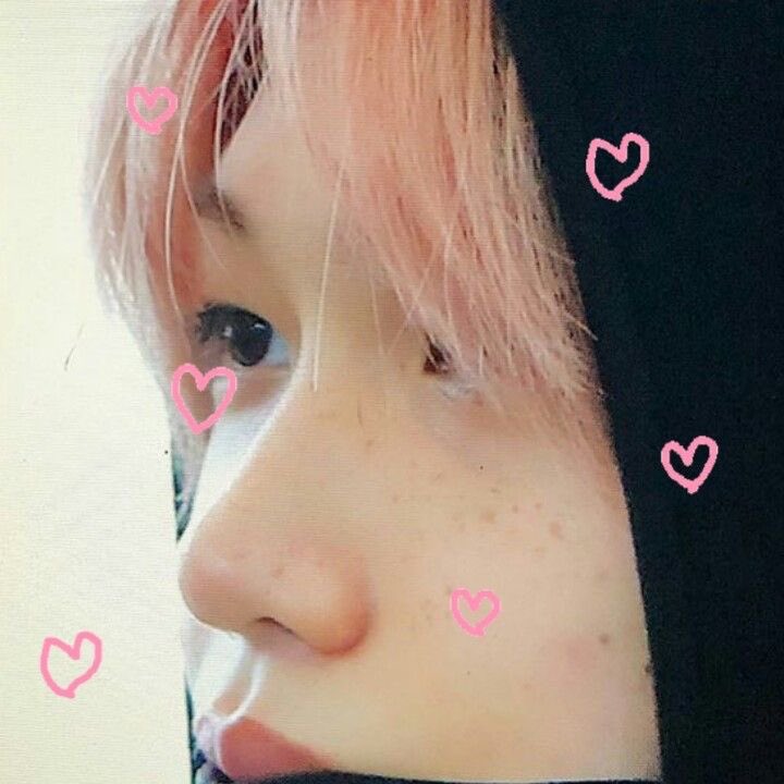 A thread of Felix beautiful freckles