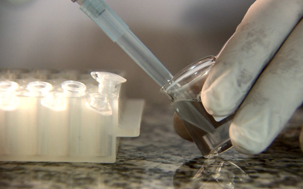 Unicamp desenvolve remédio inédito capaz de matar células do câncer de bexiga.

Medicamento é seis vezes mais potente do que o usual e pacientes desenganados apresentaram bons resultados. Estudo foi desenvolvido em Campinas.

#Cancer #oncotherad

bit.ly/3esF0x6