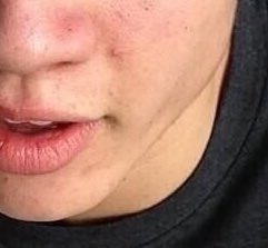 jawline.