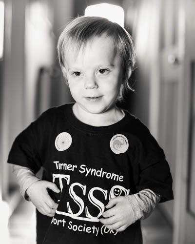NorfolkRecovery's tweet photo. Today is #TurnerSyndromeAwarenessDay Last year they launched their #MissingAnX campaign &amp; want to help all affected by Turner Syndrome! Would be so grateful if you could help us spread the word to help TS girls and women feel celebrated! #ThisIsMe #TSSS https://t.co/3hUwuATRwo https://t.co/wciUt0s1c6