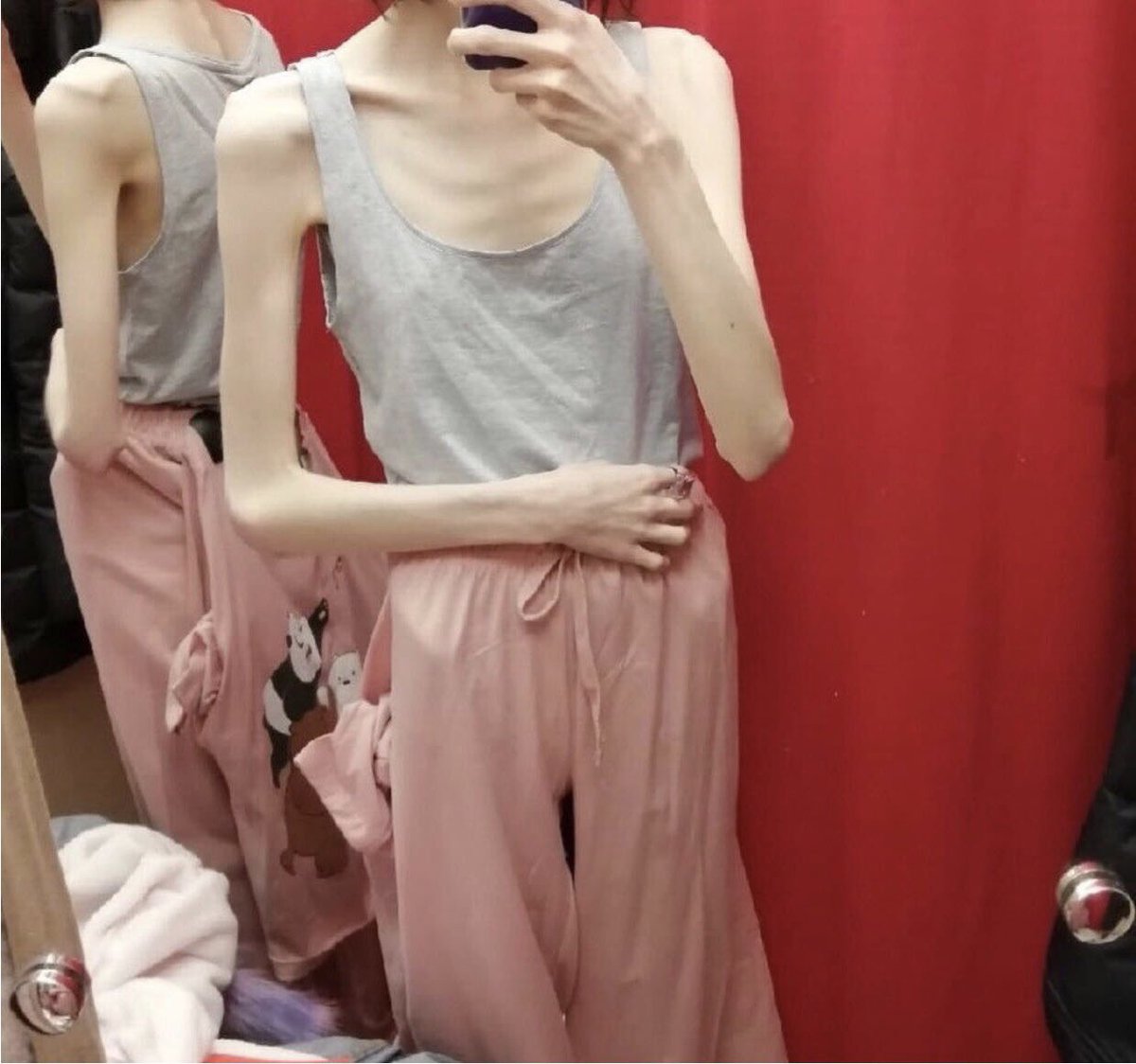 to_the_bone19's tweet photo. NOT MY PICTURES 
Absolute body goals 😍 I have such a long way to go to even look half like this

 #anorexia #anorexic #bodygoals  #thinspo #anorexic #anorexia #needtolooseweight #weightlossjourney #weightlossjourney #EDtwt https://t.co/ZLZSSZvtuC