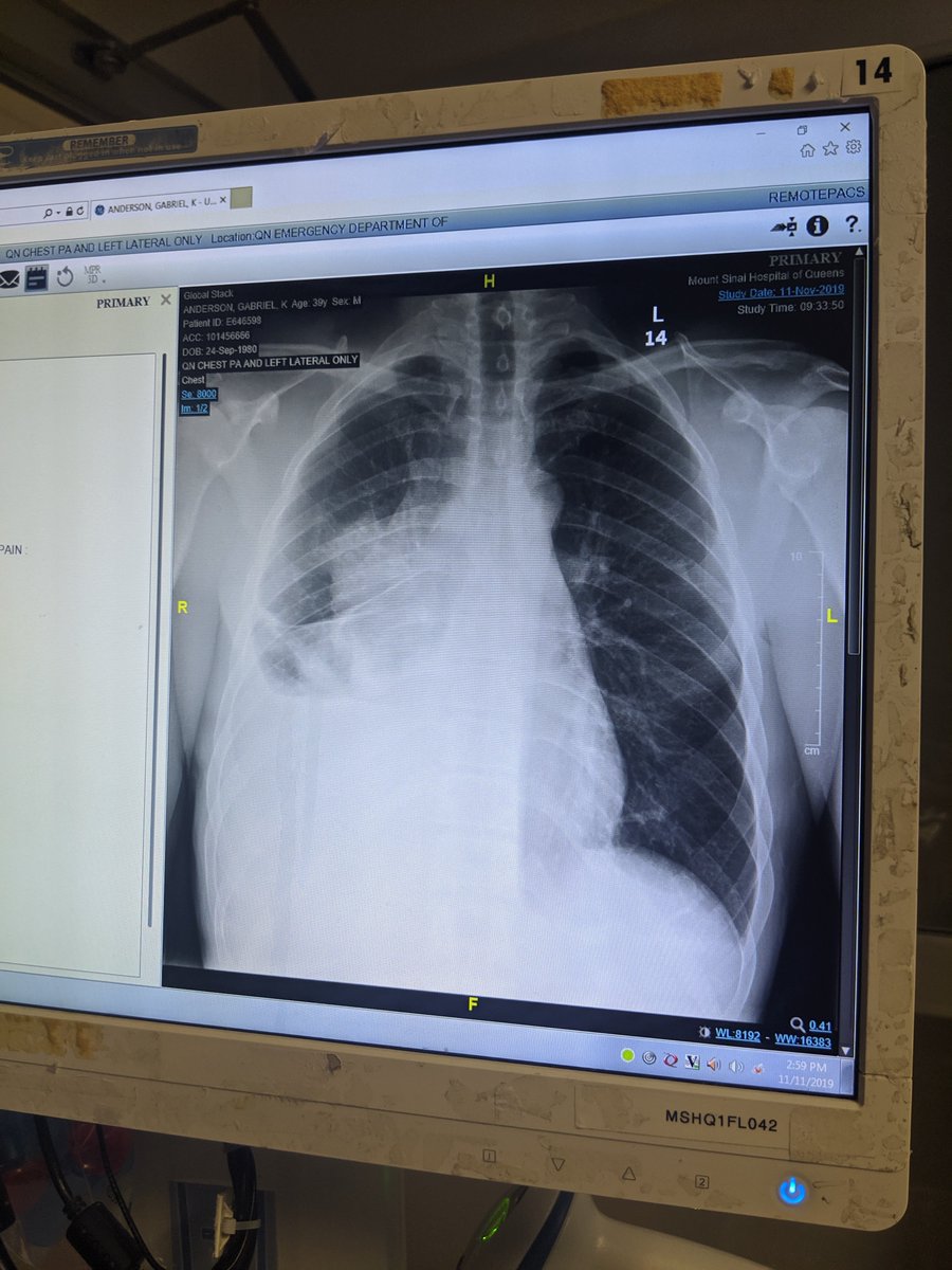 gabrielanderso's tweet image. This was difficult to write. And even more difficult to share. The End of the Beginning - My chronicles, self-reflections and journal of my cancer: 
link.medium.com/smY15CwSv7 

#Cancer #journal #personalreflections