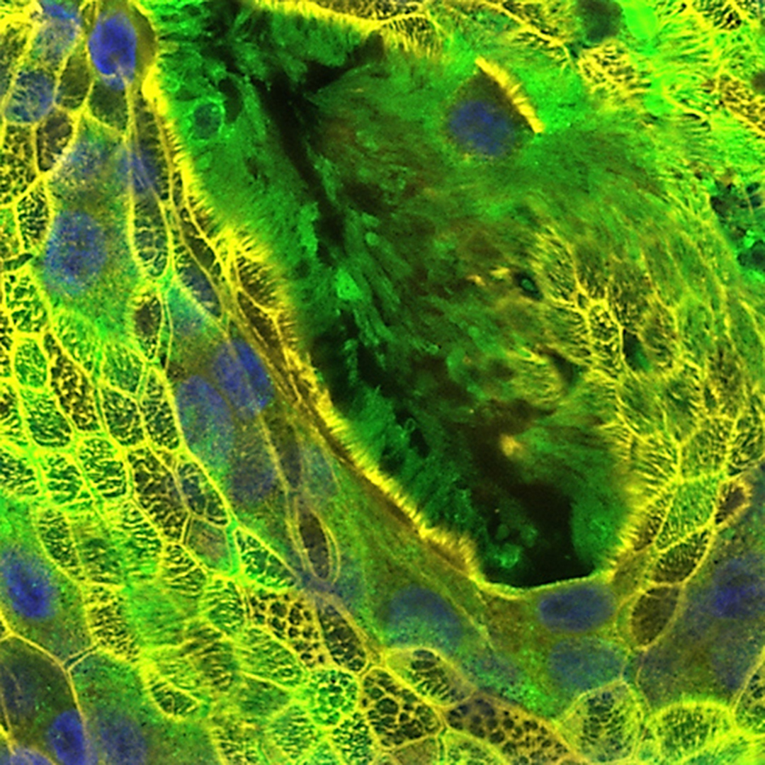 analyticaFair's tweet photo. Meistgelesene analytica-News: 
#COVID19 Simulation in der #3D Zellkultur 🧫 Neue Angriffsstrategien im Immunsystem
[German content]
https://t.co/1Ql7wwdJTL
@imed_tweets @WPosch @DorisWilflings1
#analytik #medizin #mikrobiologie #immunologie #coronavirus #SARSCoV2 #COVID19 https://t.co/pDwFp57cbo