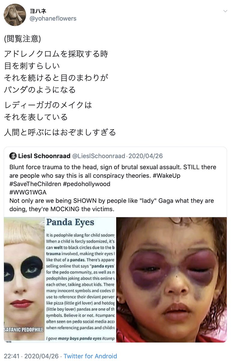 レディーガガ アドレノクロム