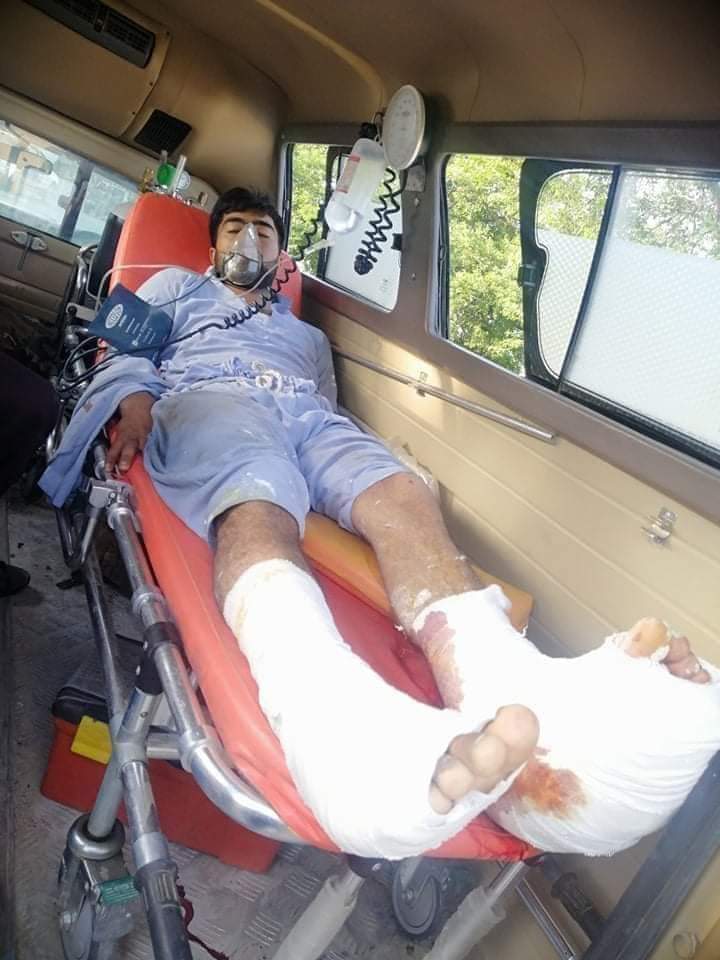 umarsherani9's tweet photo. .@hrw @humanrights1st  these are pashtun victims by #LandMines laid by #PakistaniSecurity forces .

#PakAbusingPashtunsRights https://t.co/mhhIMmFALA
