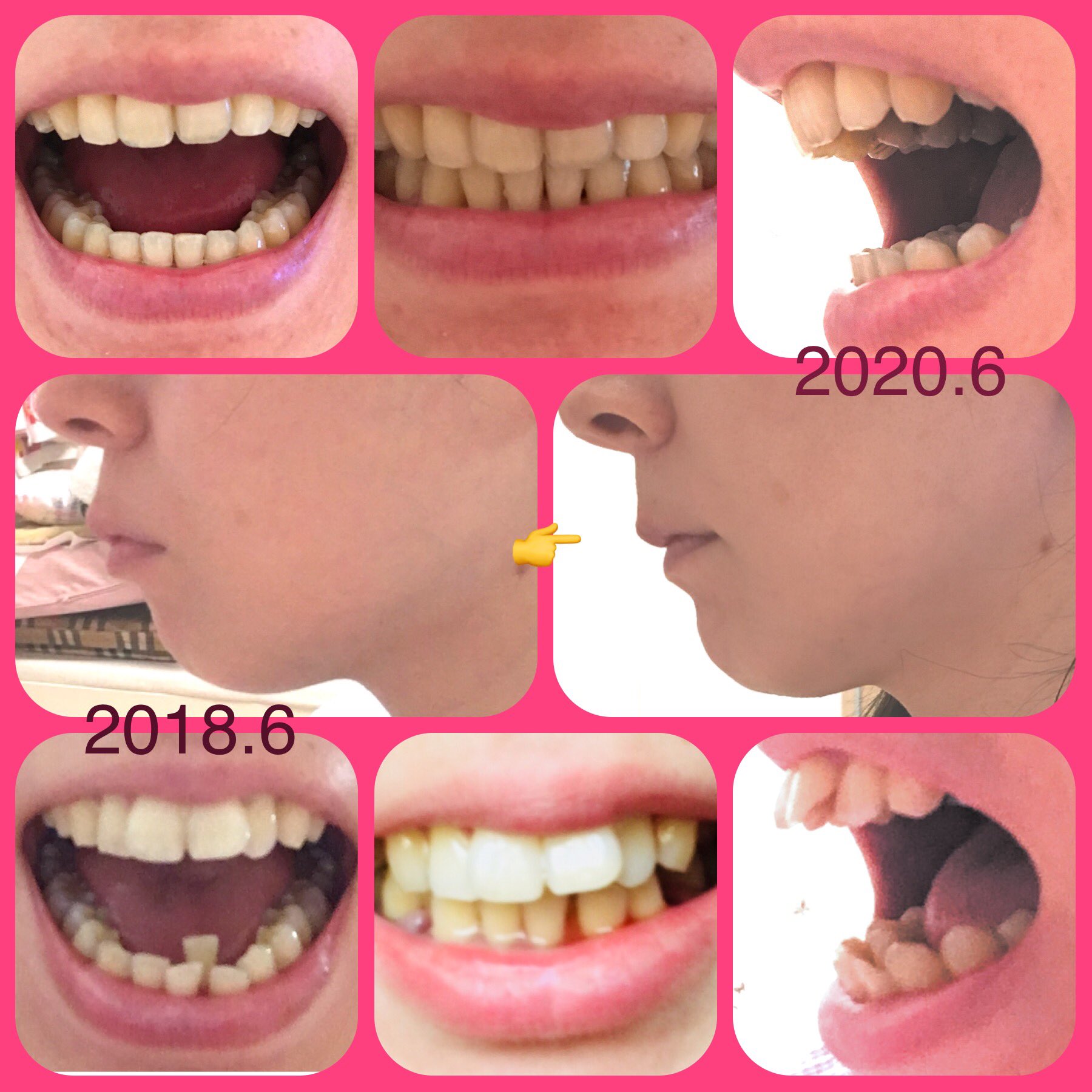 在 Twitter 上查看 Gineco Fr 的推文 Twitter