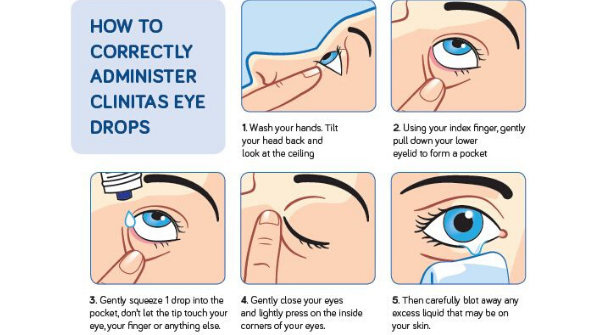 AltacorEye's tweet photo. How to correctly administer #Clinitas Eye Drops https://t.co/iOtfAEaLeX https://t.co/Aw2G8sA6rl