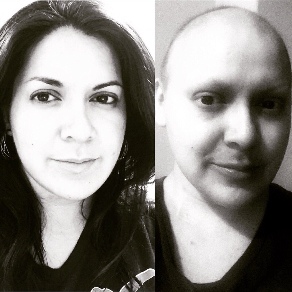 Dillon_TamiTay's tweet photo. @ThanksCancer Before and after the impact of treatment for stage 3 beast cancer.  Now I’m stage 4(metastatic) so I feel like I will always look like the girl on the right side while the girl on the left is a distant memory https://t.co/U5ylxkp6Wh