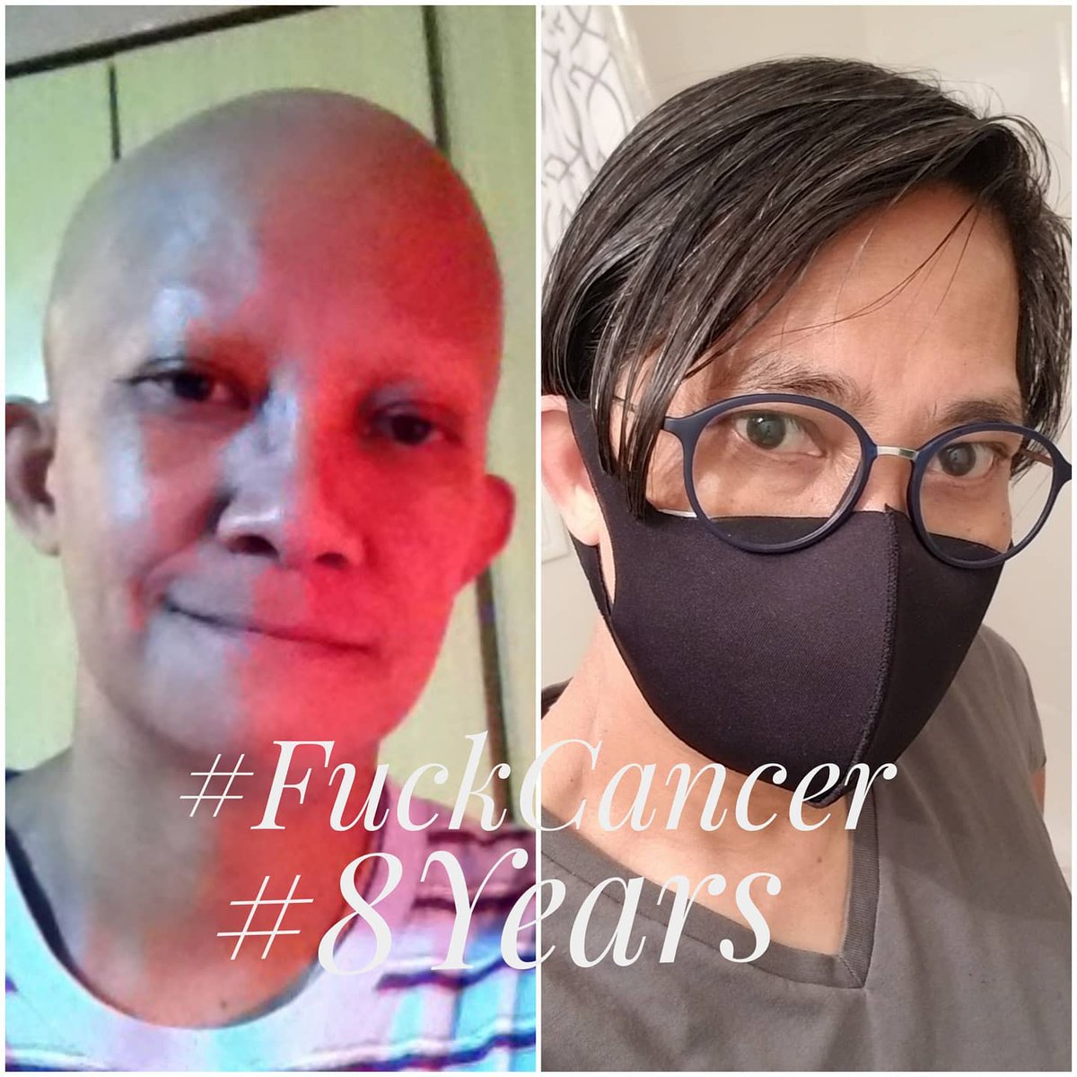 NY2Anilao's tweet photo. The fear of death has helped me survived cancer.
#FuckCancer
#EightYearsAndCounting
#CancerSurvivor
#CancerAwareness https://t.co/lTCQkwsSaF