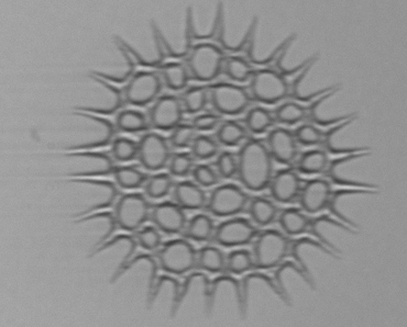 PhycoTechInc's tweet photo. Don't forget that there are lots of cool algae that are not HAB algae this time of year! This is an image of Monactinus simplex from our Imaging Flow Cytobot, Phebe. #Monactinus #supercoolalgae #ilovemyjob #youshouldalwaysnameyourinstruments https://t.co/qb2Q8ZQLcu