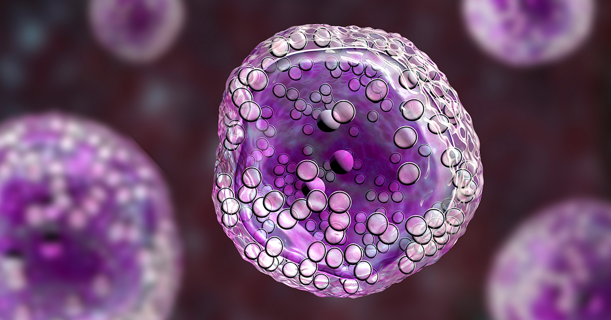 BloodCancerUtd's tweet photo. BREAKING NEWS: Today, the @US_FDA approved a new treatment option for adult patients with relapsed or refractory diffuse large B-cell #lymphoma. Read more >> https://t.co/OrO21itfa6 https://t.co/uLTPs37MxZ