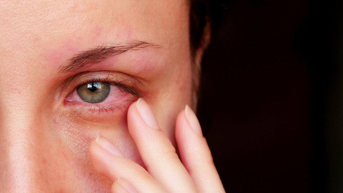 drsimonrivera's tweet photo. Las personas con ojos secos pueden notar irritación, ardor, sensación arenosa en los ojos...

¿CUALES SON TUS SINTOMAS? ⁣⁣

👨‍⚕Dr. Simon Rivera, Medico Oftalmologo especializado en Glaucoma.⁣⁣
⁣⁣
Agenda tu cita connuestro asistente virtual 🤖⁣⁣
⁣⁣
#ElSalvador #Doctor https://t.co/fIsQuWdT3z