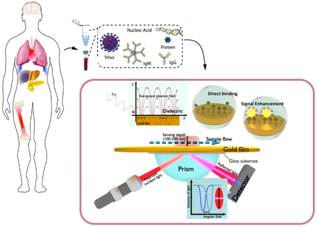 Biosensors_MDPI's tweet image. #mdpibiosensors Read a review paper &apos;Low-Fouling Substrates for Plasmonic Sensing of Circulating Biomarkers in Biological Fluids&apos; from Elba Mauriz. 
@unileon @IctalUle
More details at mdpi.com/2079-6374/10/6…
#SERS  #LSPR #nanoplasmonics