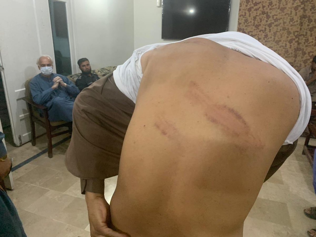 bashirgwakh's tweet image. Journalists Saeed Ali &amp;amp; Matin Achakzai were detained &amp;amp; tortured for 3 days in #Balochistan for reporting lack of facilities in quarantine center in Chaman.

Confirming the arrest, DC Bashir Barresi tells @Mashaalradio the journos had falsely accused FC of corruption.

#Pakistan