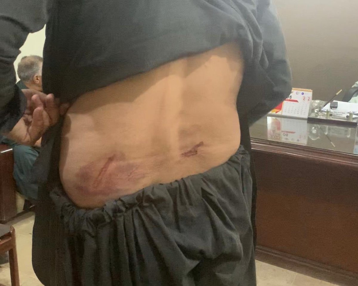 bashirgwakh's tweet image. Journalists Saeed Ali &amp;amp; Matin Achakzai were detained &amp;amp; tortured for 3 days in #Balochistan for reporting lack of facilities in quarantine center in Chaman.

Confirming the arrest, DC Bashir Barresi tells @Mashaalradio the journos had falsely accused FC of corruption.

#Pakistan