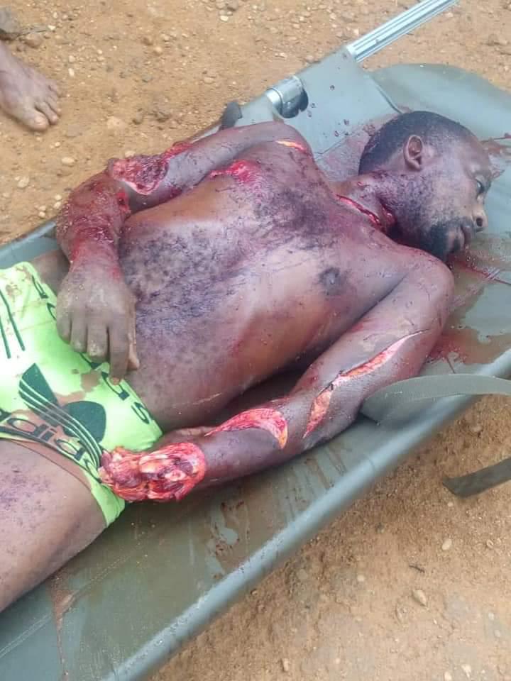 EstoppelP's tweet photo. @AmbazoniaM @realBrotherJero @fomslyw @NzajeP @AustinTapm @UN @MsLaToshaBrown @AC360 @CohenOnAfrica @hrw @amnesty @PastorDawkins @USUN @SecPompeo @Refugees @PressSec @antonioguterres @AsstSecStateAF @StateDept @GOVUK @EUatUN @NRC_Egeland @USAmbUN @mbachelet @BelgiumUN @UKParliament @RepKarenBass @GermanyUN @realDonaldTrump @amnestyusa @SCRtweets @USIP @SenateForeign @DicarloRosemary La Rep. du cameroUn is taking advantage of the feet dragging by the int'l community to bring her to book for the massacres in Ambazonia to commit more crimes. In a typical #French #colonial style on the bamileke in cameroUn, they slaughter & #behead #Ambazonians. #EVIL, #demonism https://t.co/svlZH7hidO