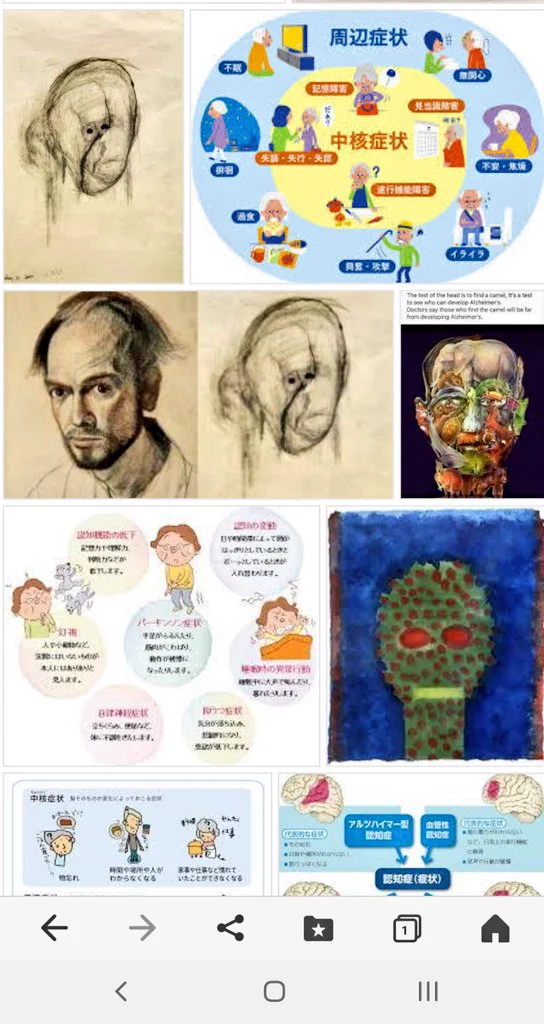 @8min_a もしかしてコンピューターもアルツハイマー病にかかるんか？ 