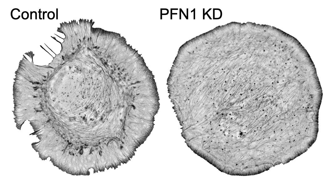 Here are some 3D-SIM images which show you just how different the actin looks when you knockdown PFN1. 5/