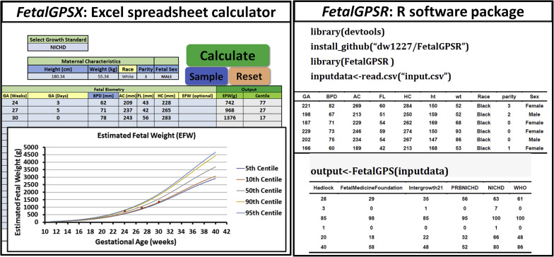 Ajog On Twitter Fetal Growth Percentile Software A Tool To Calculate Estimated Fetal Weight Percentiles For 6 Standards Https T Co Ppejk1n6wq Ultrasound Pregnancy Obgyn Https T Co Gzta2qdl8y