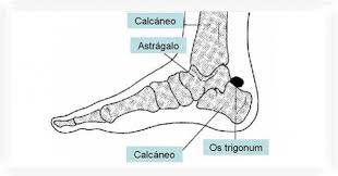 sasutra3's tweet photo. Síndrome de la cola del #Astragalo
https://t.co/4jQMWKyHMf https://t.co/MXO7k3jZ1P