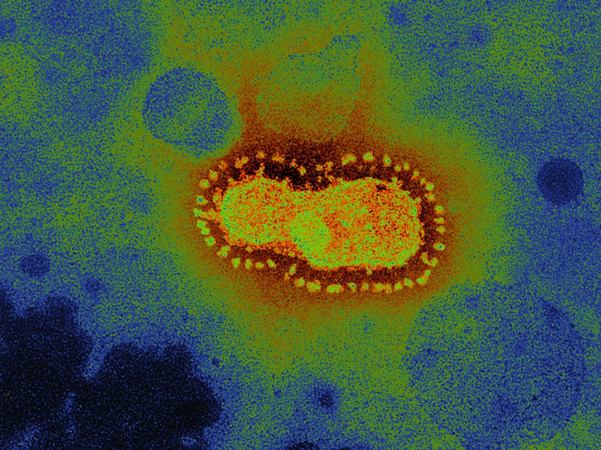 Sars-CoV-2, the virus that causes Covid-19, mutates very slightly once every two or so transmissions.These mutations don’t alter the virus meaningfully, but they do allow us to track the path it’s taken  http://trib.al/OBYzOVt 