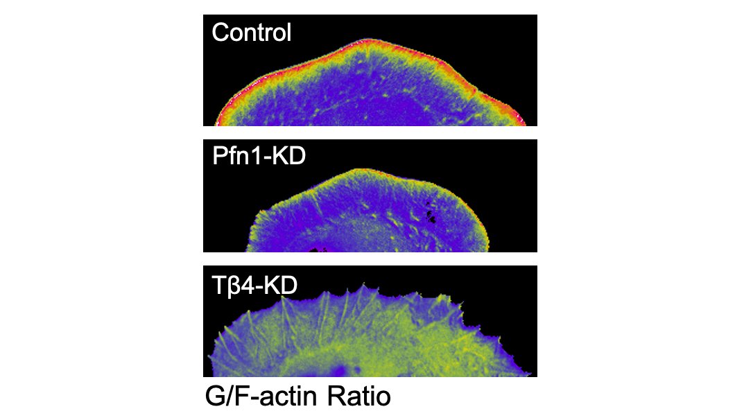 We did shRNA knockdown of the monomer binding heavyweights Profilin 1 (PFN1) and Thymosin β4 (Tβ4) to see if they were involved in monomer localization to the leading edge. Surprisingly, it was Tβ4 that was largely responsible. 3/