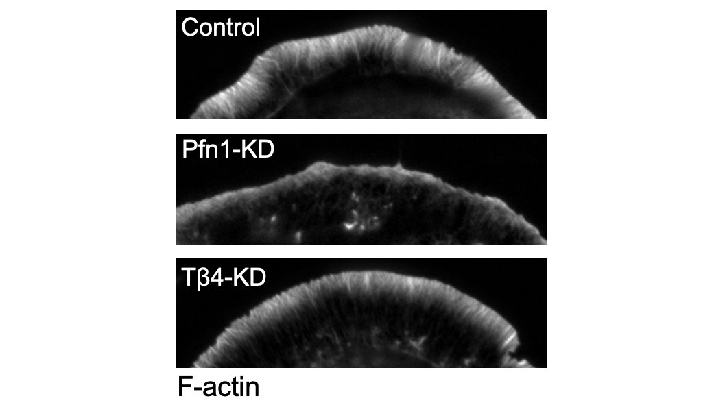 However, knocking down PFN1 really did a number on the leading edge, which had way less actin and was much smaller than control cells. PFN1 was obviously important for actin assembly there. 4/
