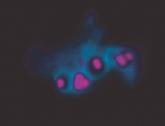 New paper from the Johnston lab: Autophagy, neutrophils and S. aureus! 

Staph are unbelievably cunning at escaping the immune system but we can show how neutrophils can use 'xenophagy' to control escaping bacteria

tandfonline.com/doi/full/10.10…