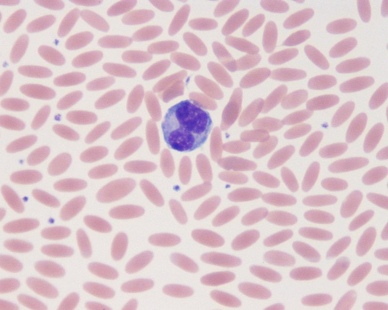 SophieMacura's tweet photo. Animal haematology is wild. Bird 🦅 red cells are all nucleated and camel 🐫 red cells are all pencil shaped. Dogs 🐶 blood grouping is based on dog erythrocyte antigen (DEA) system and cats 🐱 have A, B and AB blood groups (but no O blood group). 🤯🤯 https://t.co/K1JUDNNcBY