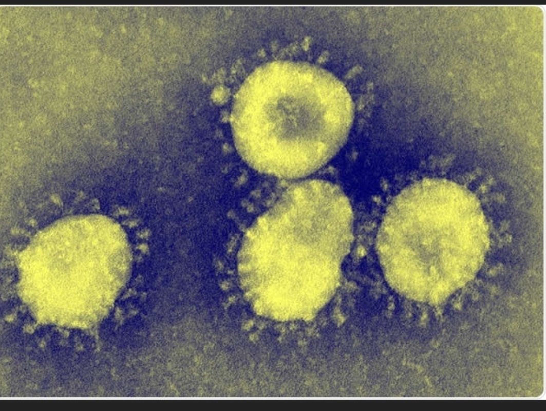 I saw something the other day I thought was interesting. Someone saying all virus pics are not virus pics at all.So I started to look into it. This 1st image is CV virus with artificial colour added.