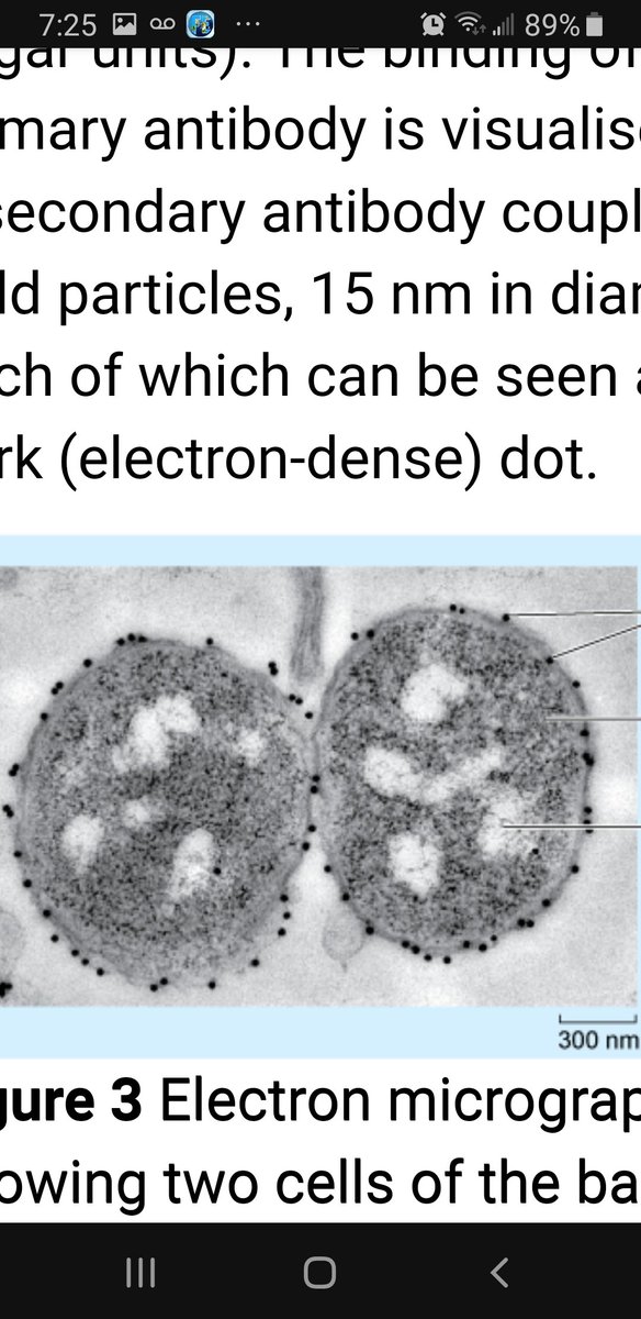 Now lets look at regular cells. The one with tubes is on a plate with some microtubes its pulling towards itself. As you can see, all of these cells have particles sticking to them.