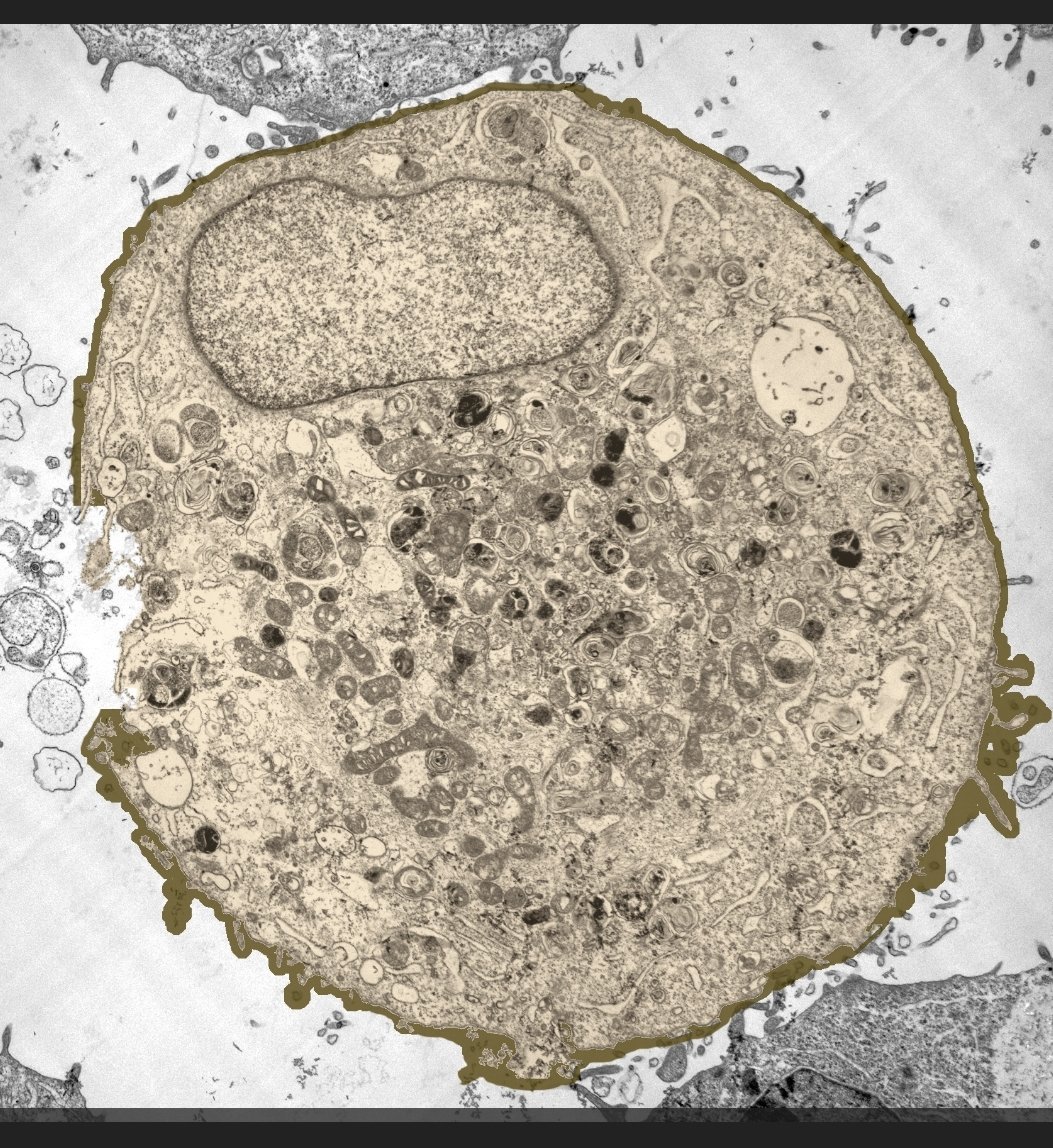 Now lets look at regular cells. The one with tubes is on a plate with some microtubes its pulling towards itself. As you can see, all of these cells have particles sticking to them.