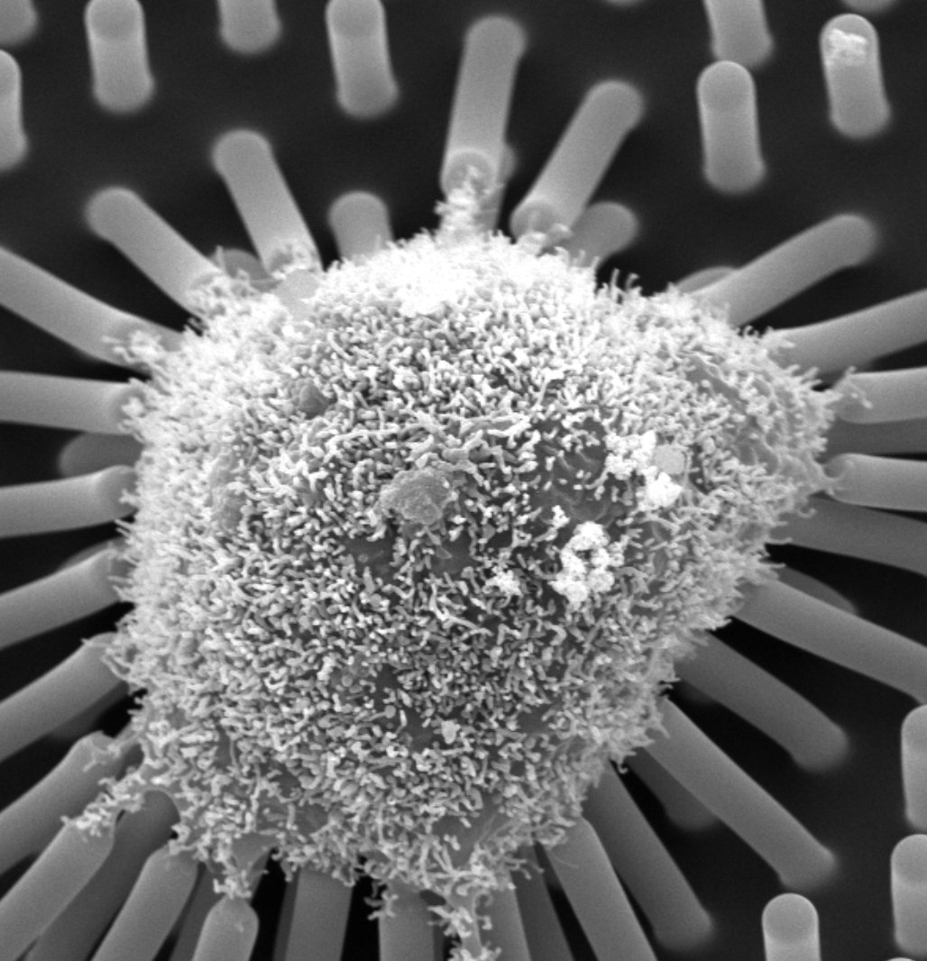 Now lets look at regular cells. The one with tubes is on a plate with some microtubes its pulling towards itself. As you can see, all of these cells have particles sticking to them.