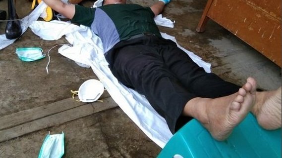 Masuk ke fokus utama thread tentang pingsanDON'T PANICudah jelas lah yaDO1. telentangkan korban pada bidang datar. Angkat kaki korban lebih tinggi dari jantung