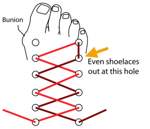 activealignment's tweet photo. Shoe Fit Issues?

Simply changing your lacing technique can improve comfort and fit, allowing for more space in the shoe for areas of high pressure or friction.
https://t.co/jqOPygQdKa

 #shoes #walking #run #kwawesome #hike #comfort #comfortrightoutofthegait #activealignment https://t.co/17dLMqrhum