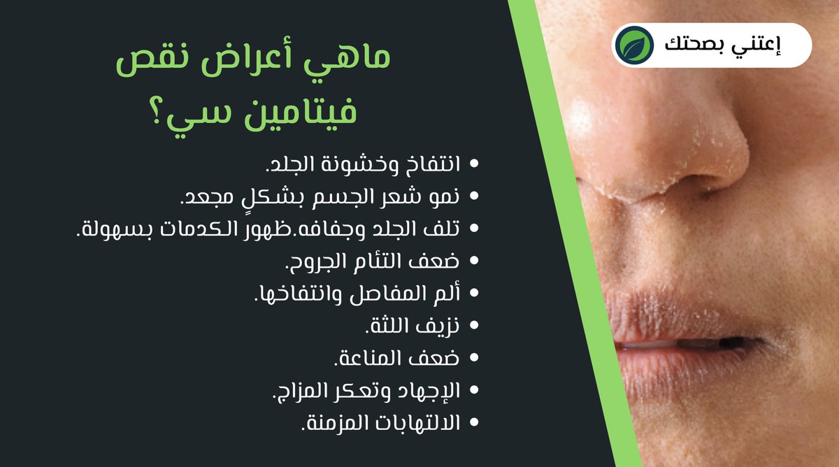 قسم إعتني بصحتك"

من فوائد فيتامين سي:
مكافحة الانفلونزا ونزلات البرد
الحماية من الأشعة الضارة
التقليل من التجاعيد
تعزيز صحة العيون

 فيتامين سي:
bit.ly/2CrQUZI

إقرأ المزيد:
bit.ly/2NqbpIK